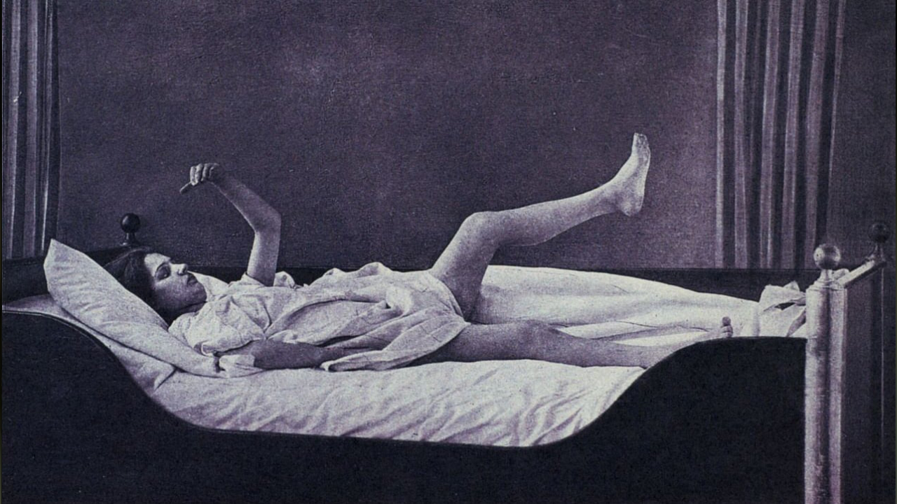 katatonik-sizofreni