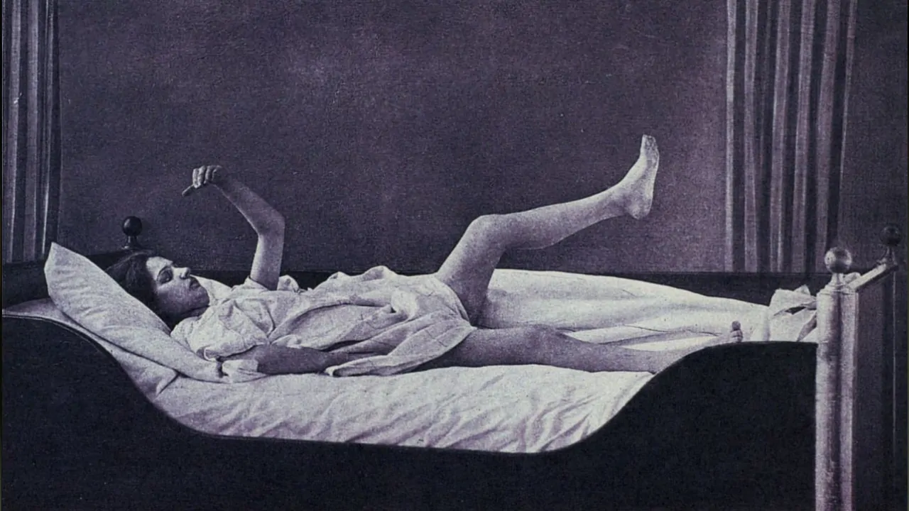 katatonik-sizofreni